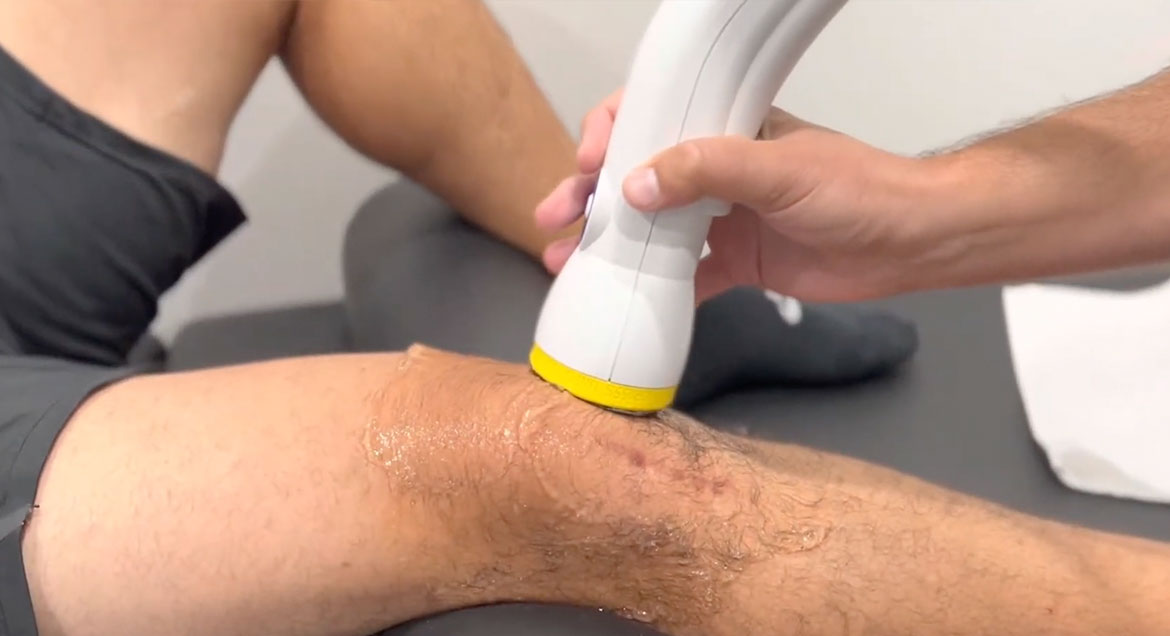 Advanced Knee Pain Relief with SoftWave Therapy in NJ at Central Jersey Spine & Wellness